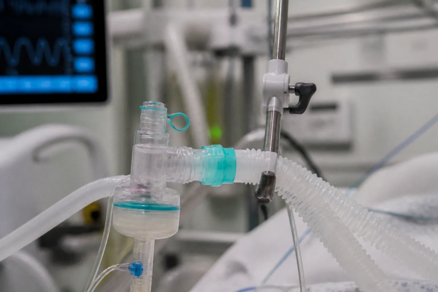Ventilation et cerveau : concilier protection pulmonaire et neurologique en réanimation